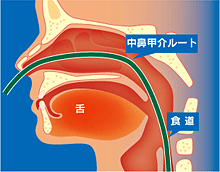 経鼻内視鏡