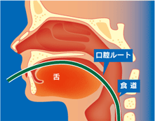 経口内視鏡