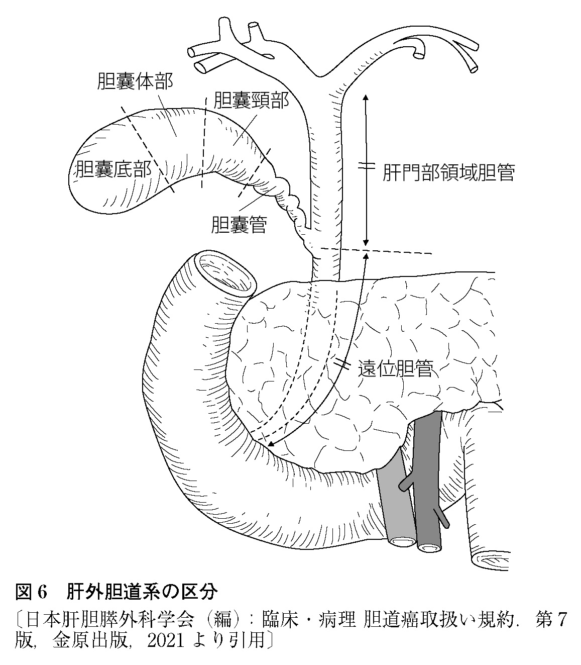 肝門部領域胆管